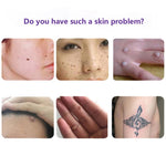Painless Mole Skin Dark Spot Removal Face Wart Tag Freckle Removal Cream Oil Mole Skin Tag Removal Solution