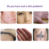 Painless Mole Skin Dark Spot Removal Face Wart Tag Freckle Removal Cream Oil Mole Skin Tag Removal Solution